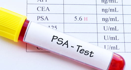PSA test for early detection of prostate cancer