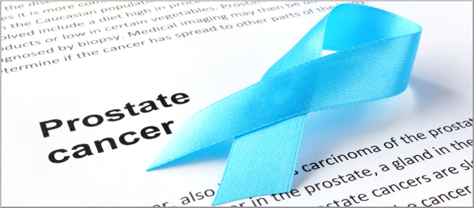Laboratory testing for prostate cancer prevention